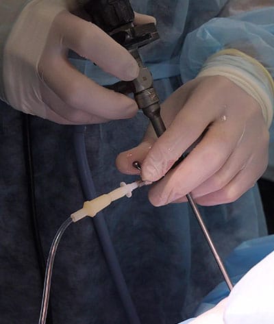Close-up of gloved hands adjusting medical equipment during a surgical procedure, performed by a veterinarian in blue surgical attire. A white tube connects to the equipment, ensuring precision and care.