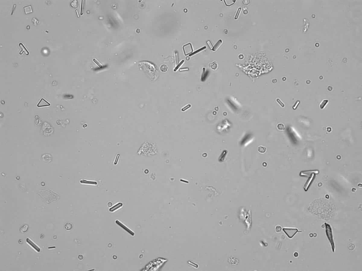 A microscopic view reveals variously shaped and sized crystal structures on a gray background, depicted in grayscale. Like a veterinarian examining under a microscope, the crystals are scattered throughout the image, showcasing diverse geometric forms.